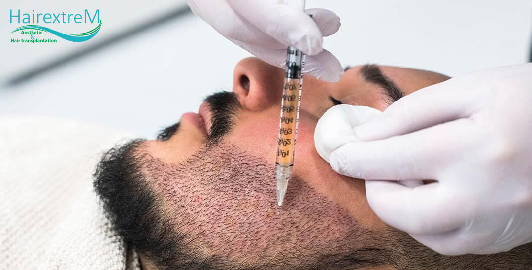 A quoi faut-il prêter une attention particulière après une greffe de barbe DHI?