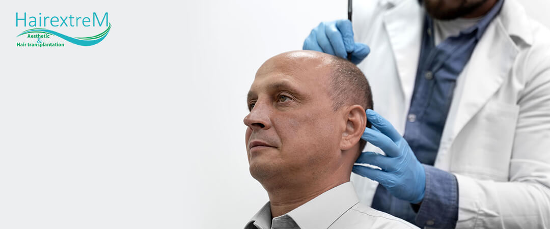 Le meilleur centre de greffe de cheveux en Turquie