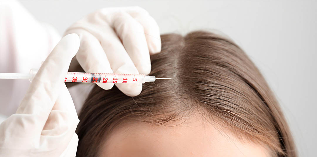 Préparation avant une greffe de cheveux