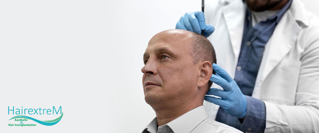 Wie Viele Tage Kann Ich Nach Der Haartransplantation Wieder Zur Arbeit Gehen?