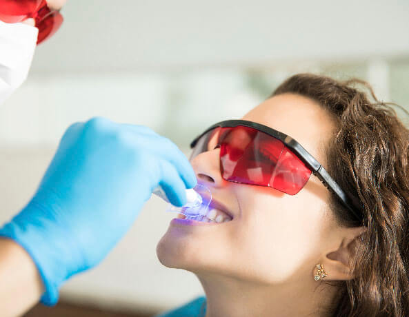 تبييض الأسنان في تركيا