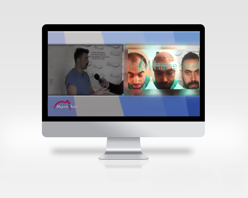 HairextreM Saç Ekim Merkezi