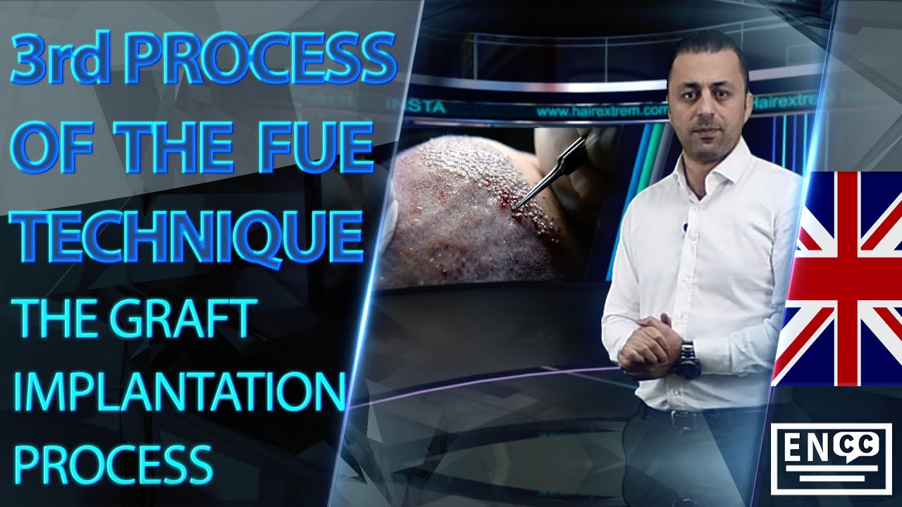 Greffe de Barbe Turquie